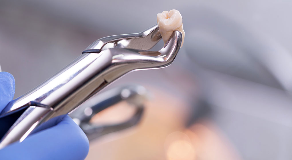 難抜歯や顎関節症などの口腔外科